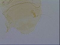 Echiniscus testudo image