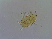Echiniscus testudo image