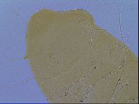 Echiniscus testudo image