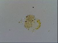 Echiniscus testudo image