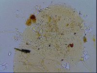 Echiniscus testudo image