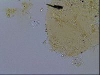 Echiniscus testudo image