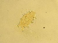 Echiniscus testudo image