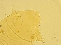 Echiniscus testudo image