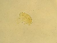 Echiniscus testudo image