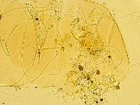 Echiniscus testudo image