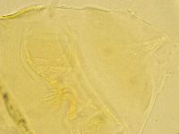 Echiniscus trisetosus image