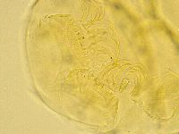 Echiniscus trisetosus image