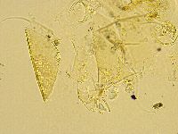 Echiniscus trisetosus image