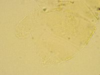 Echiniscus trisetosus image