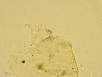 Echiniscus trisetosus image