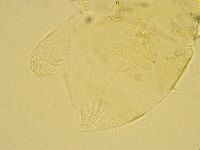 Echiniscus trisetosus image