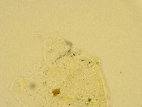 Echiniscus trisetosus image