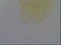 Echiniscus trisetosus image