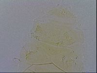 Echiniscus trisetosus image