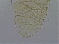 Echiniscus trisetosus image