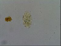 Echiniscus trisetosus image