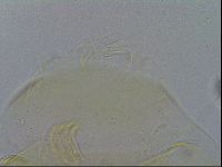 Echiniscus trisetosus image
