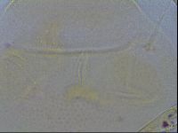 Echiniscus trisetosus image