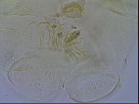 Echiniscus trisetosus image