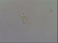 Echiniscus trisetosus image