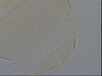 Echiniscus trisetosus image