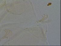 Echiniscus trisetosus image