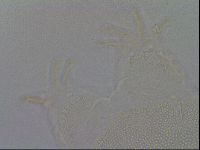 Echiniscus trisetosus image