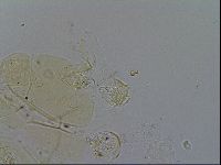 Echiniscus trisetosus image