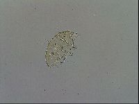 Echiniscus trisetosus image
