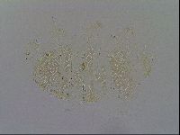 Echiniscus trisetosus image