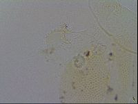 Echiniscus trisetosus image