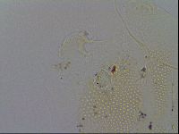Echiniscus trisetosus image