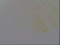 Echiniscus trisetosus image