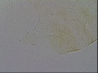 Echiniscus trisetosus image