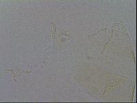 Echiniscus trisetosus image