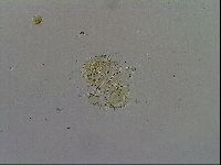 Echiniscus trisetosus image