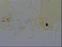Echiniscus trisetosus image