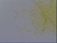 Echiniscus trisetosus image