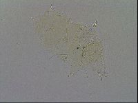 Echiniscus trisetosus image