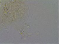 Echiniscus trisetosus image