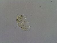 Echiniscus trisetosus image