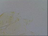 Echiniscus trisetosus image