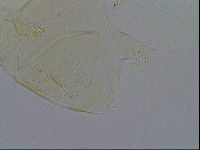 Echiniscus trisetosus image