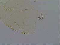Echiniscus trisetosus image