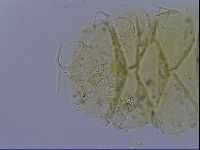 Echiniscus trisetosus image
