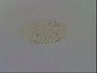 Echiniscus trisetosus image