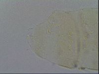 Echiniscus trisetosus image