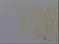 Echiniscus trisetosus image