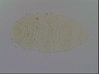 Echiniscus trisetosus image